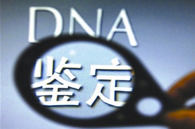 DNA