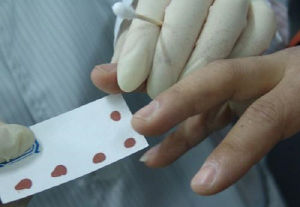 亲子鉴定手续